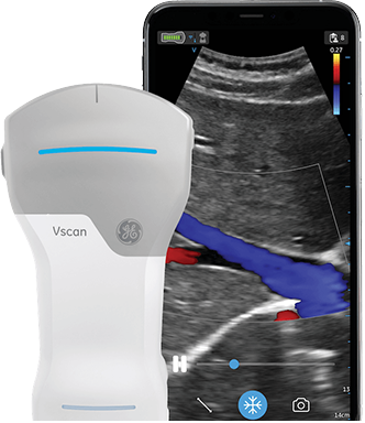 ge医疗器械怎么样GE医疗，加码这一领域_https://www.jmylbn.com_新闻资讯_第10张