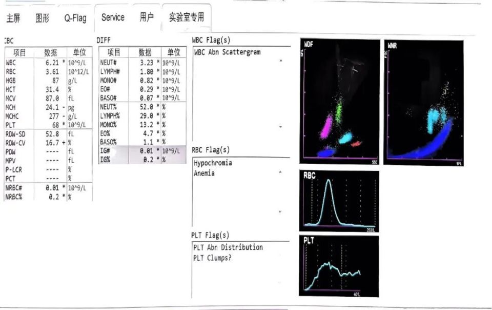 血常规直方图与散点图图片