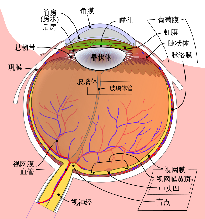 眼球新生血管图片图片