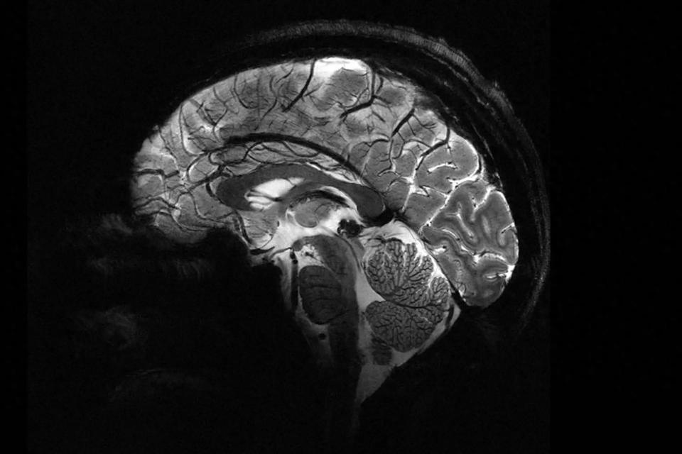 世界上最强大的核磁共振成像仪首次捕捉到令人震惊的脑部扫描