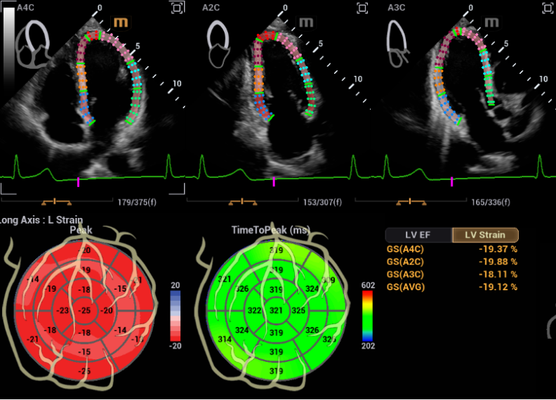 骨盆手术器械有哪些2023十大自主创新医疗器械产品_https://www.jmylbn.com_新闻资讯_第33张