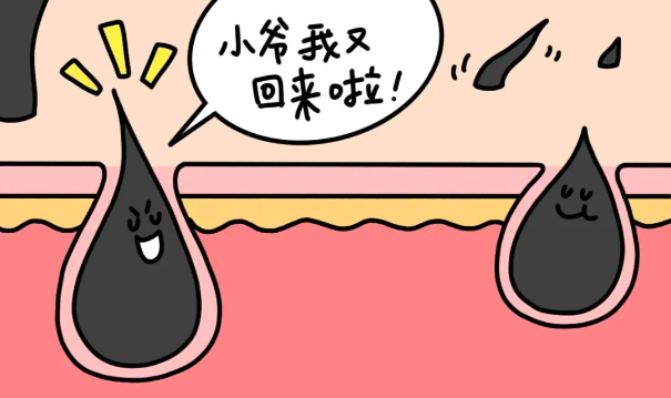 真的,别乱剃体毛!