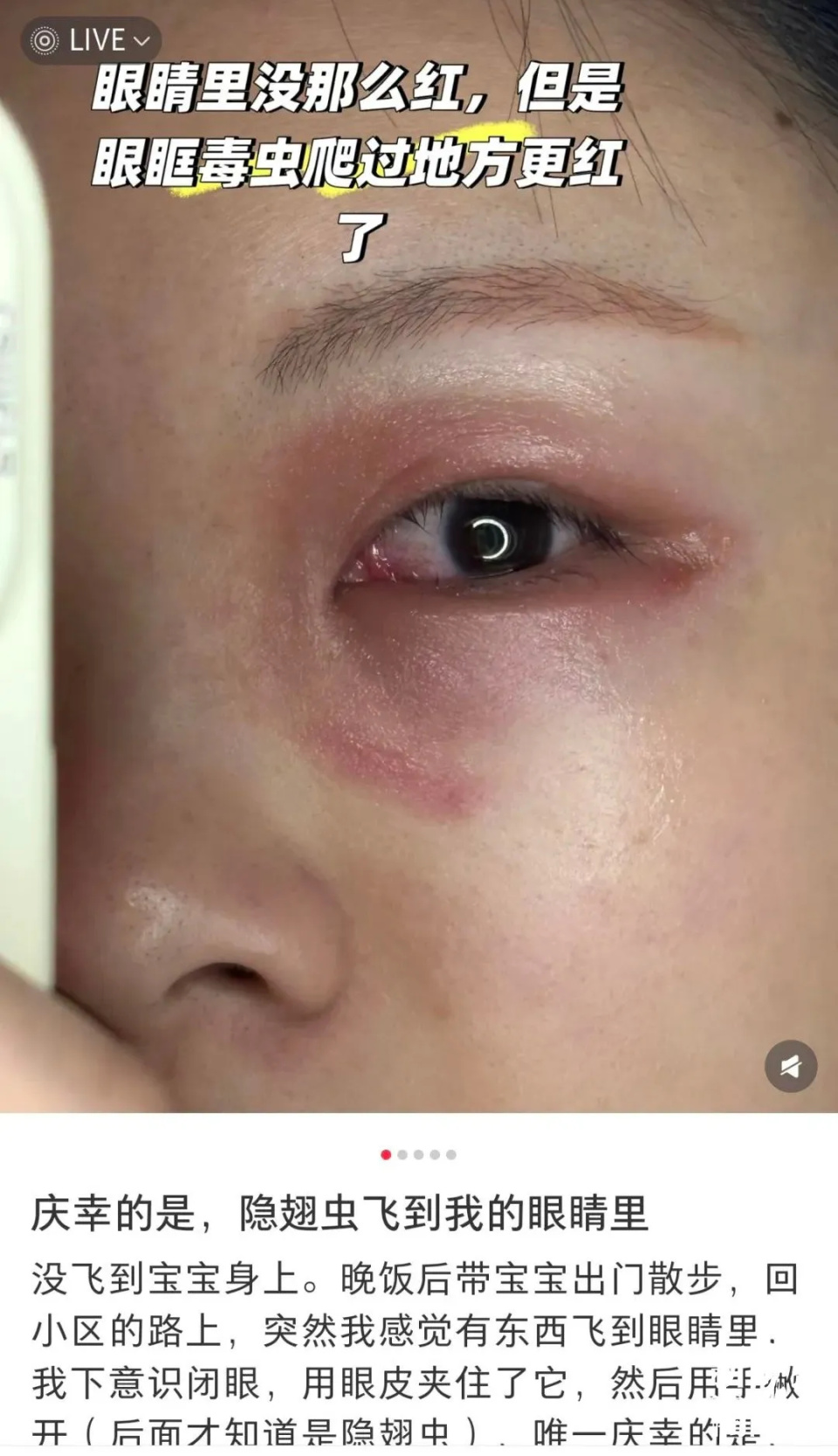 女子随手一拍,脸被灼伤,有人差点毁容!上海有人中招!毒液堪比硫酸