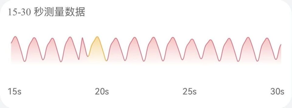 心电图机怎么维护别等“系统报错”才想起维护：一份写给当代打工人的心脏运维指南_https://www.jmylbn.com_新闻资讯_第14张