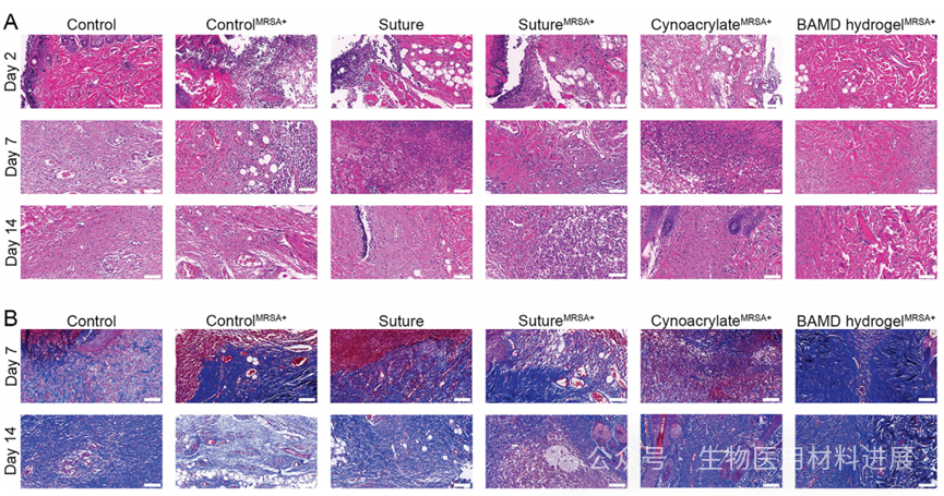 医用抗菌水凝胶怎么用《AFM》湖北大学吴水林／河工大刘想梅： 多模式消毒功能的强粘附Janus水凝胶，用于多重耐药金葡球菌感染的开放性伤口快速修复_https://www.jmylbn.com_新闻资讯_第9张