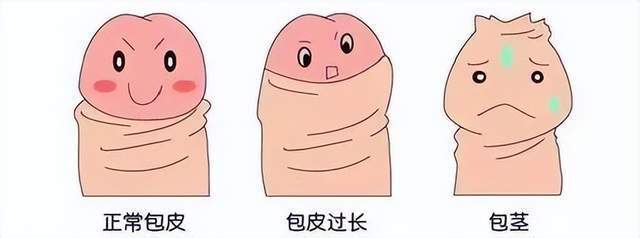 一般男孩子的包皮有三种状态:正常,包皮过长,包茎.什么是包皮?