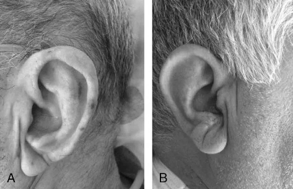 出现这6种"面相",千万别忽视!可能是疾病的征兆