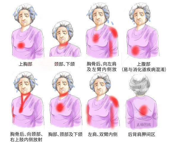 心绞痛位置图片早期图片