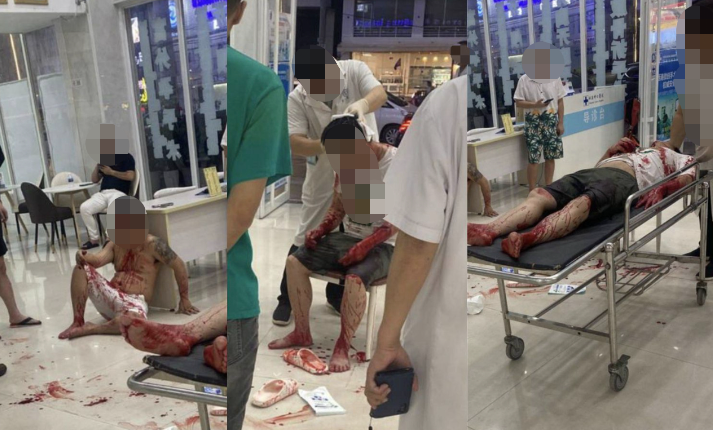 昨晚,西港发生砍人事件,3人被砍伤