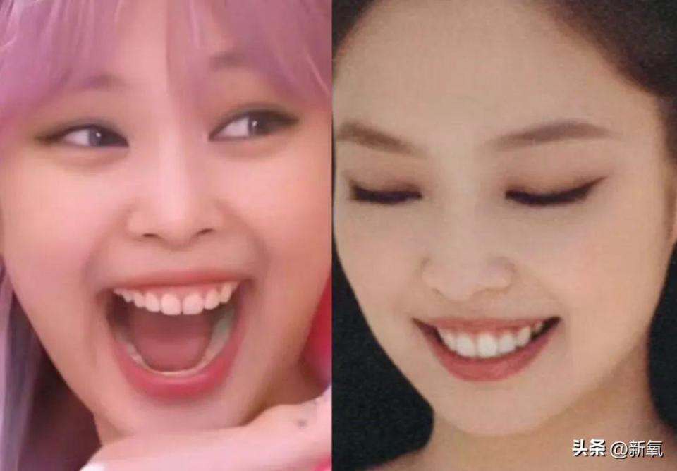 宁可面相变刻薄也要改这里,只有我为jennie感到不值吗?_腾讯新闻
