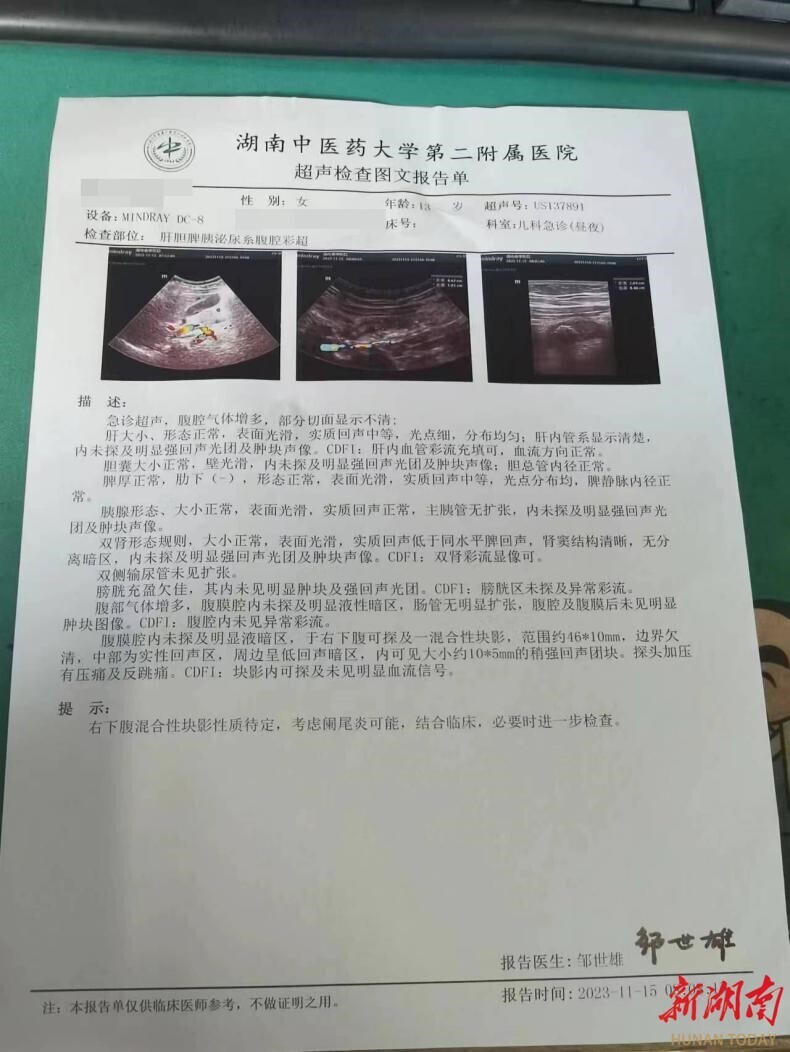 孩子腹痛莫轻视当心急性阑尾炎