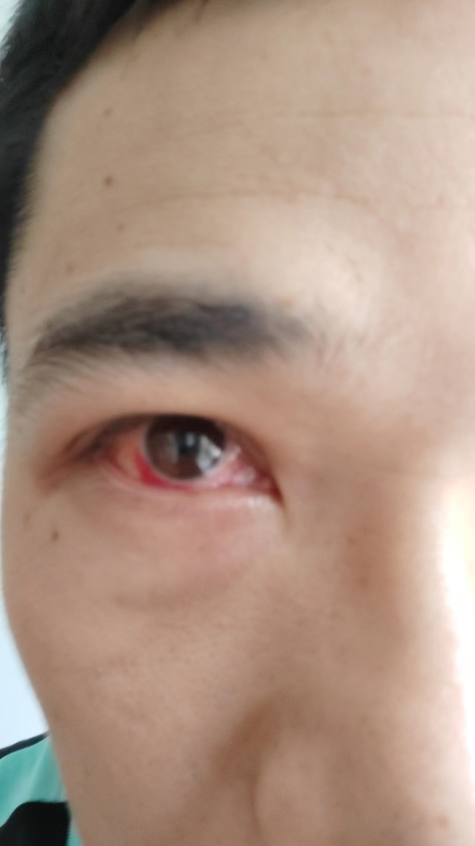 ""最初受伤时,光线稍微强