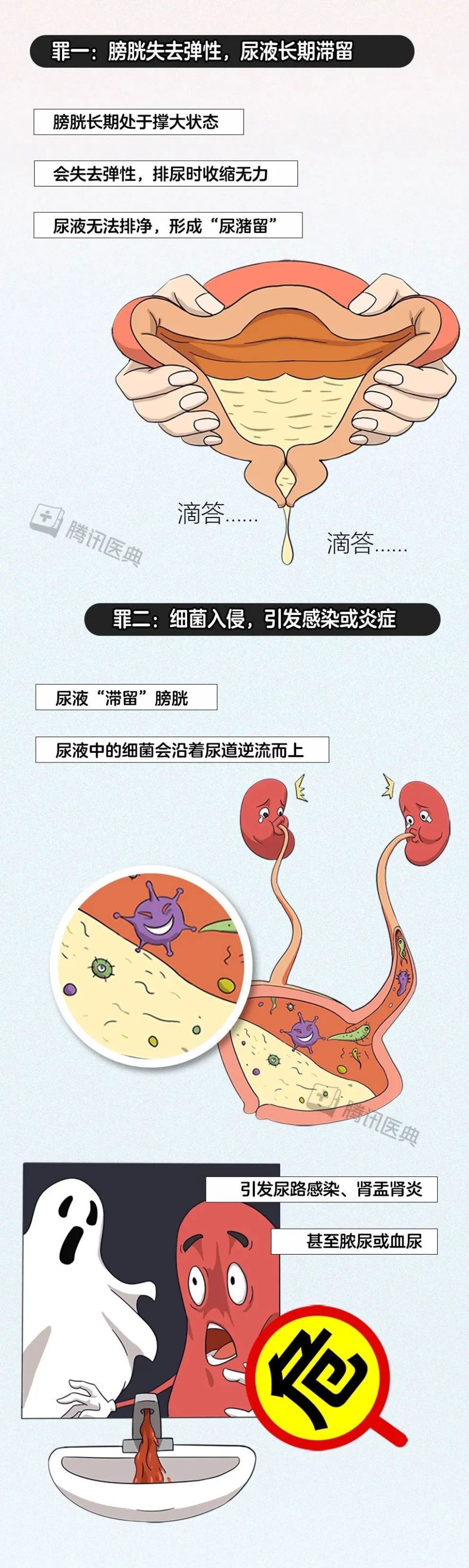 尿憋久了小腹疼怎么办(尿憋久了小腹疼怎么回事)