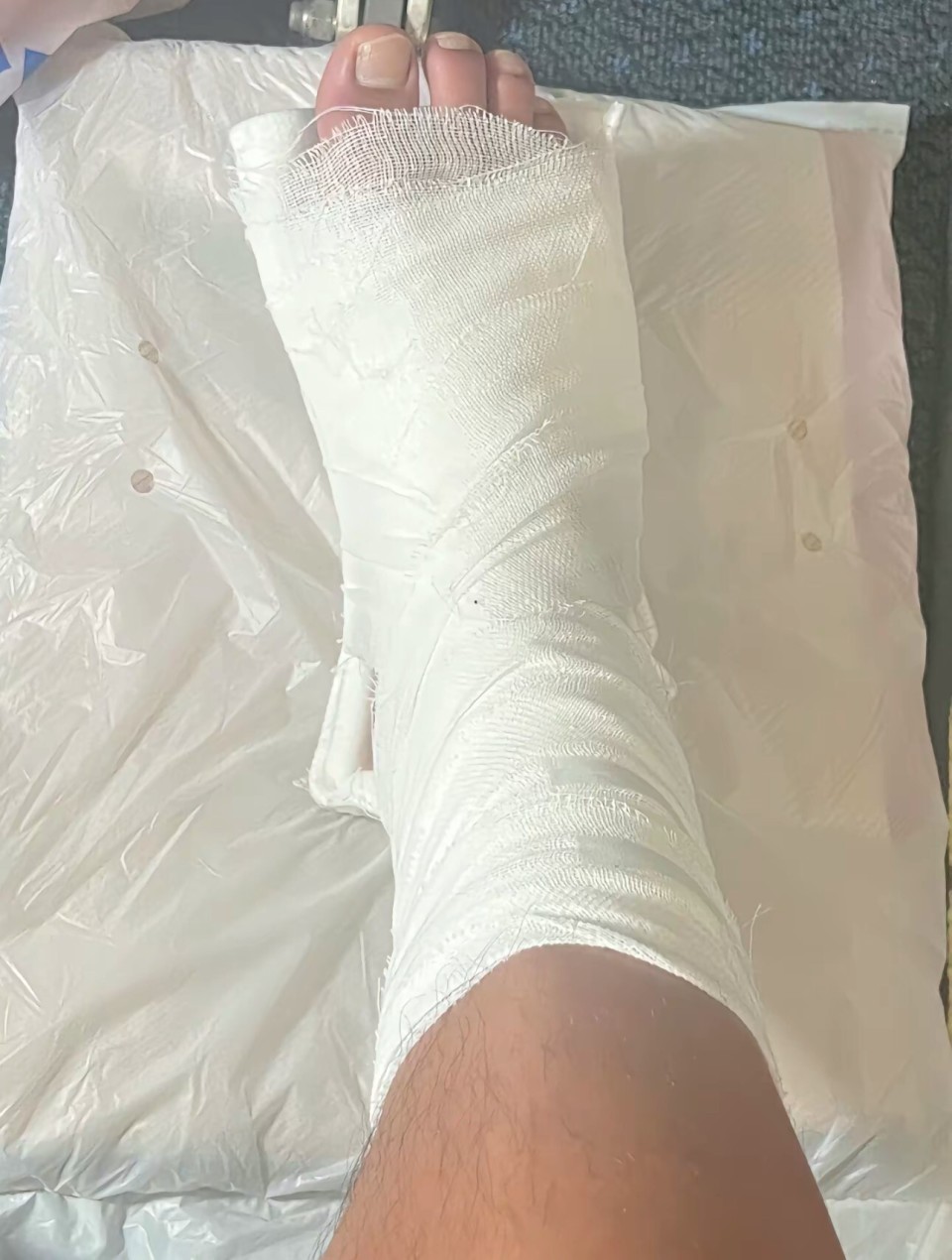 海港小将蒯纪闻遭遇右足第5跖骨骨折:积极康复,下半年见