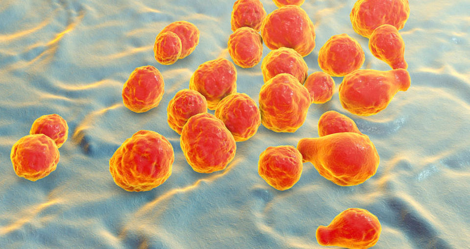 病例共读丨一例罕见隐球菌性脑膜炎和脑血管炎_腾讯新闻