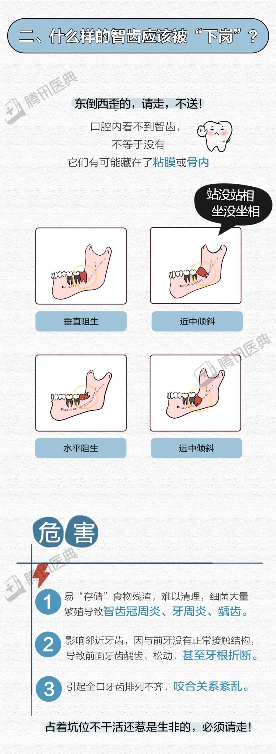 智齿应该"下岗"还是留着?你的疑问一次说清