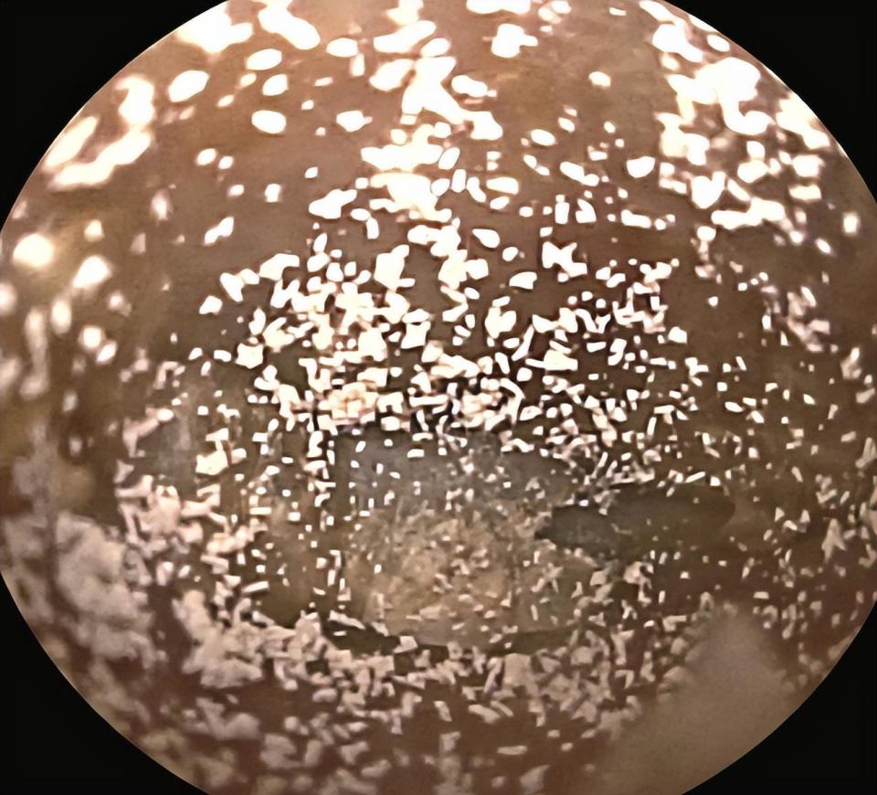 男子耳朵奇痒无比,居然是"发霉"了?听听耳鼻咽喉科专家怎么说