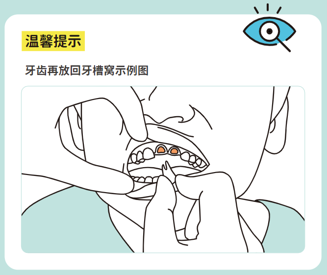 纱布为什么能止血这12种常见意外你会处理吗？收藏这份居家“救命”手册_https://www.jmylbn.com_新闻资讯_第2张