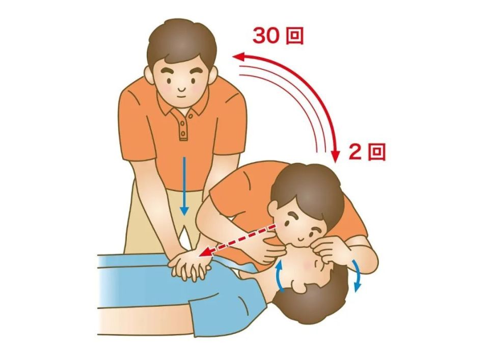 急救科普 | 心肺复苏(cpr)全攻略