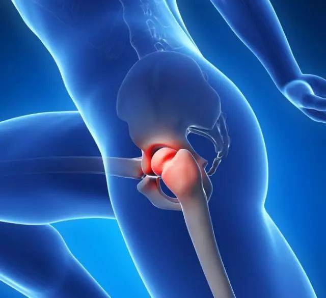 警惕强直性脊柱炎致残杀手:髋关节受累,4类人更易中招!_腾讯新闻