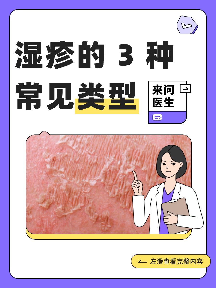 湿疹能自愈吗?
