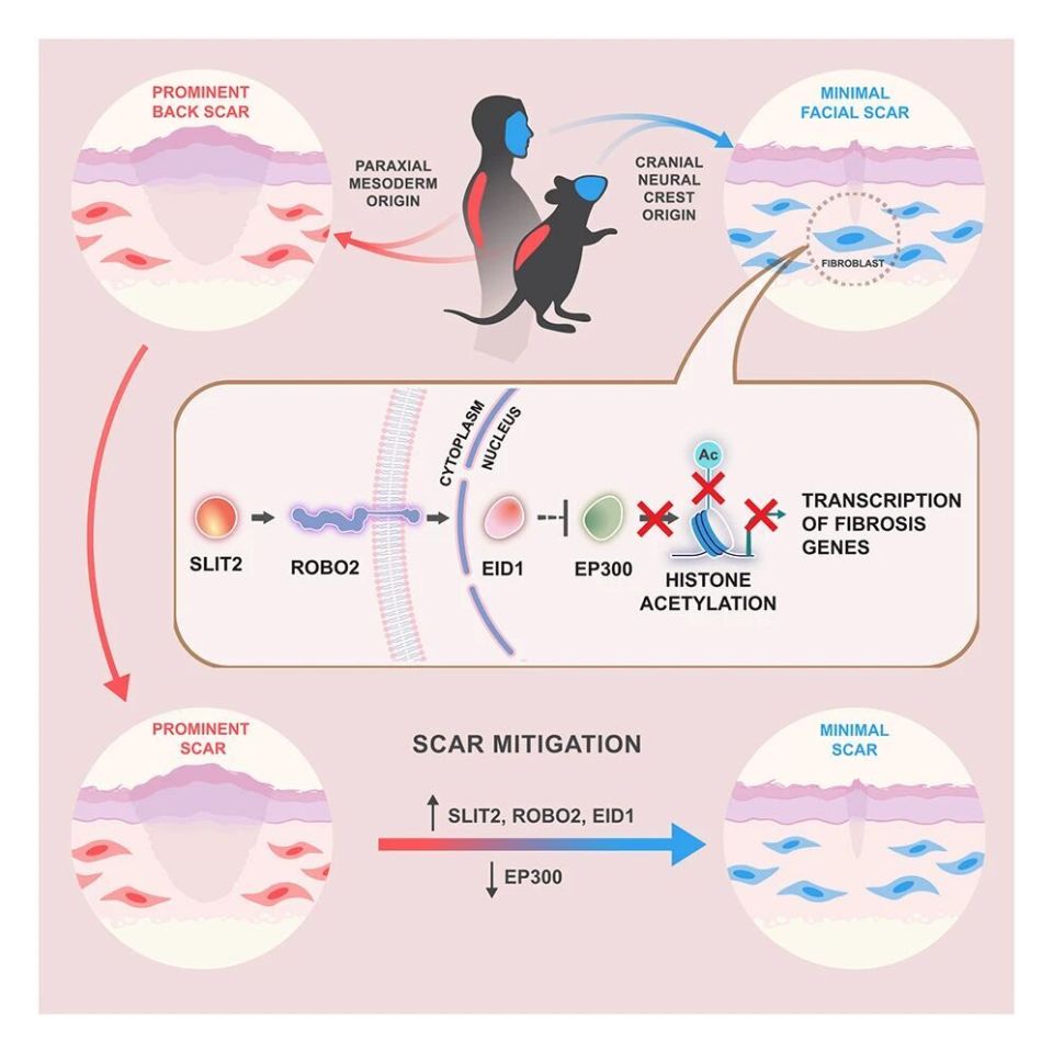 medtronic起博器怎么样追问daily ｜ Cell：为什么脸上受伤不易留疤？神经元并非只靠糖分运作；脑积水实为脉动能量吸收障碍所致_https://www.jmylbn.com_新闻资讯_第3张
