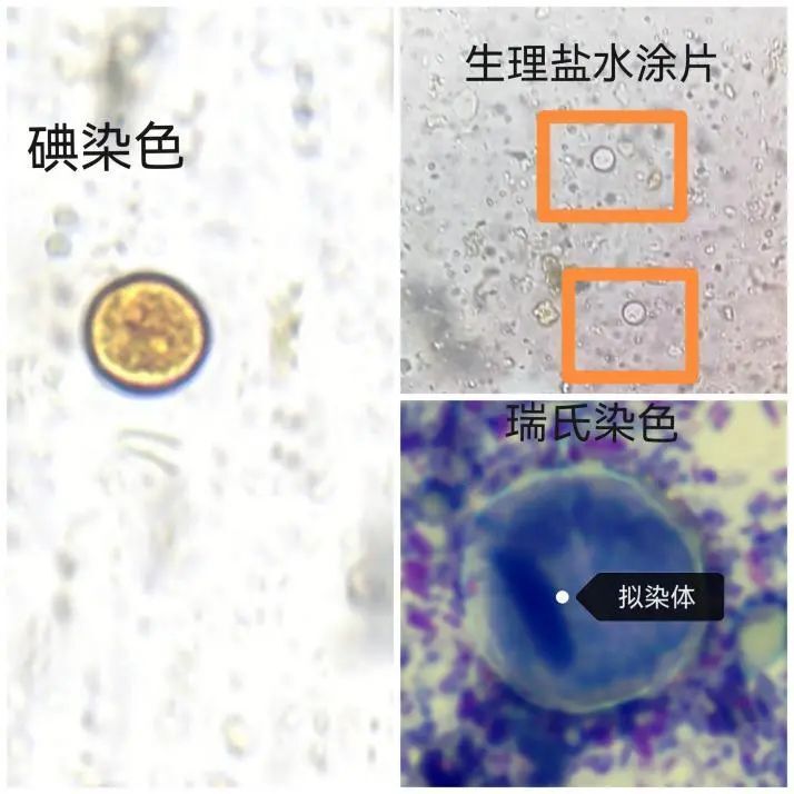 大便镜检寄生虫图片