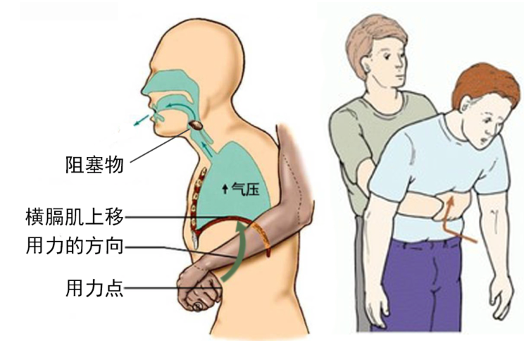 心肺复苏按压位置图图片