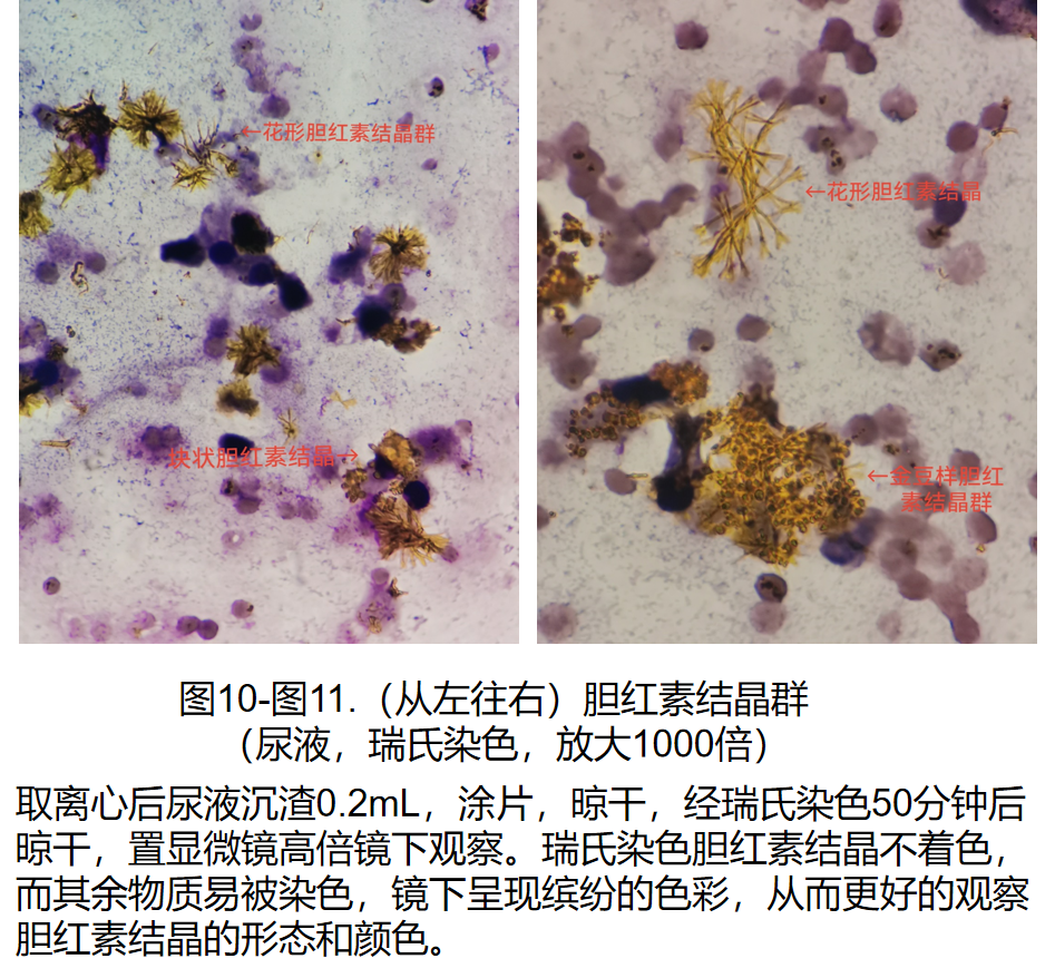 梅毒螺旋体镀银图片