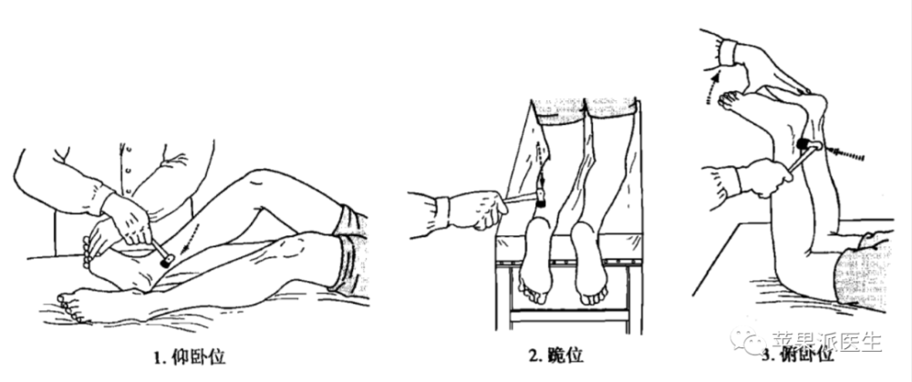 牵张反射和腱反射图片