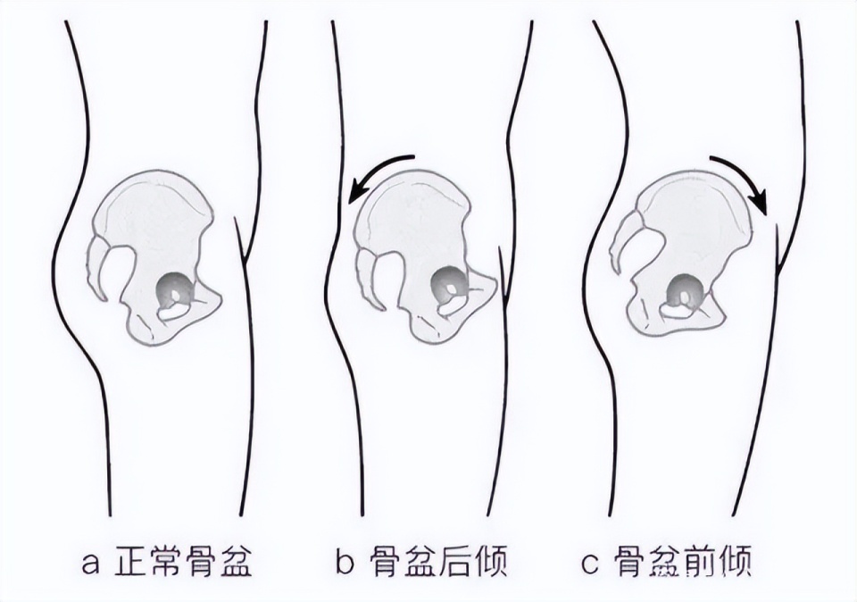 骨盆入口左斜径图片图片