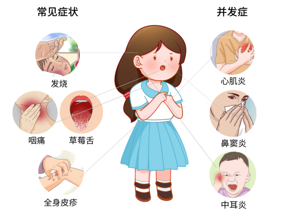 2~10岁儿童容易被感染,猩红热早期症状不典型,主要是发烧和喉咙痛