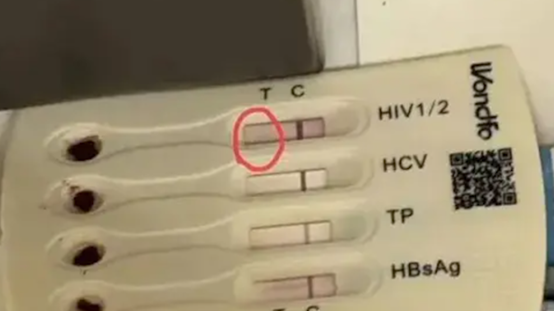 入住北京酒店洗漱包现用过的HIV检测盒，