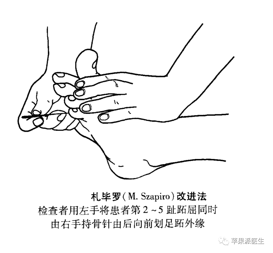 理解Babinski征，划对Babinski征_腾讯新闻