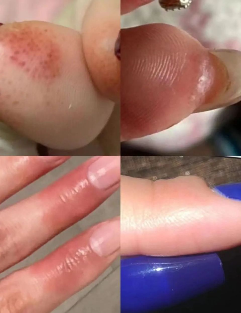 看不下去了!经常做美甲,指甲居然会变成这样