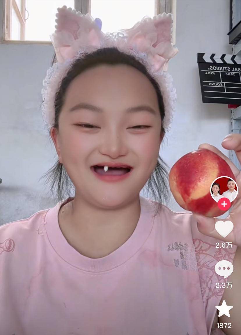 河北女子用一颗牙啃水果引关注，先天性缺牙