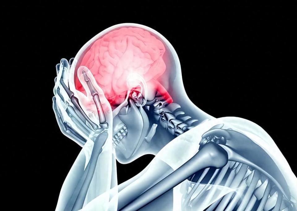 脑梗是"吃"出来的?医生提醒:不想堵塞血管,3种食物不要吃