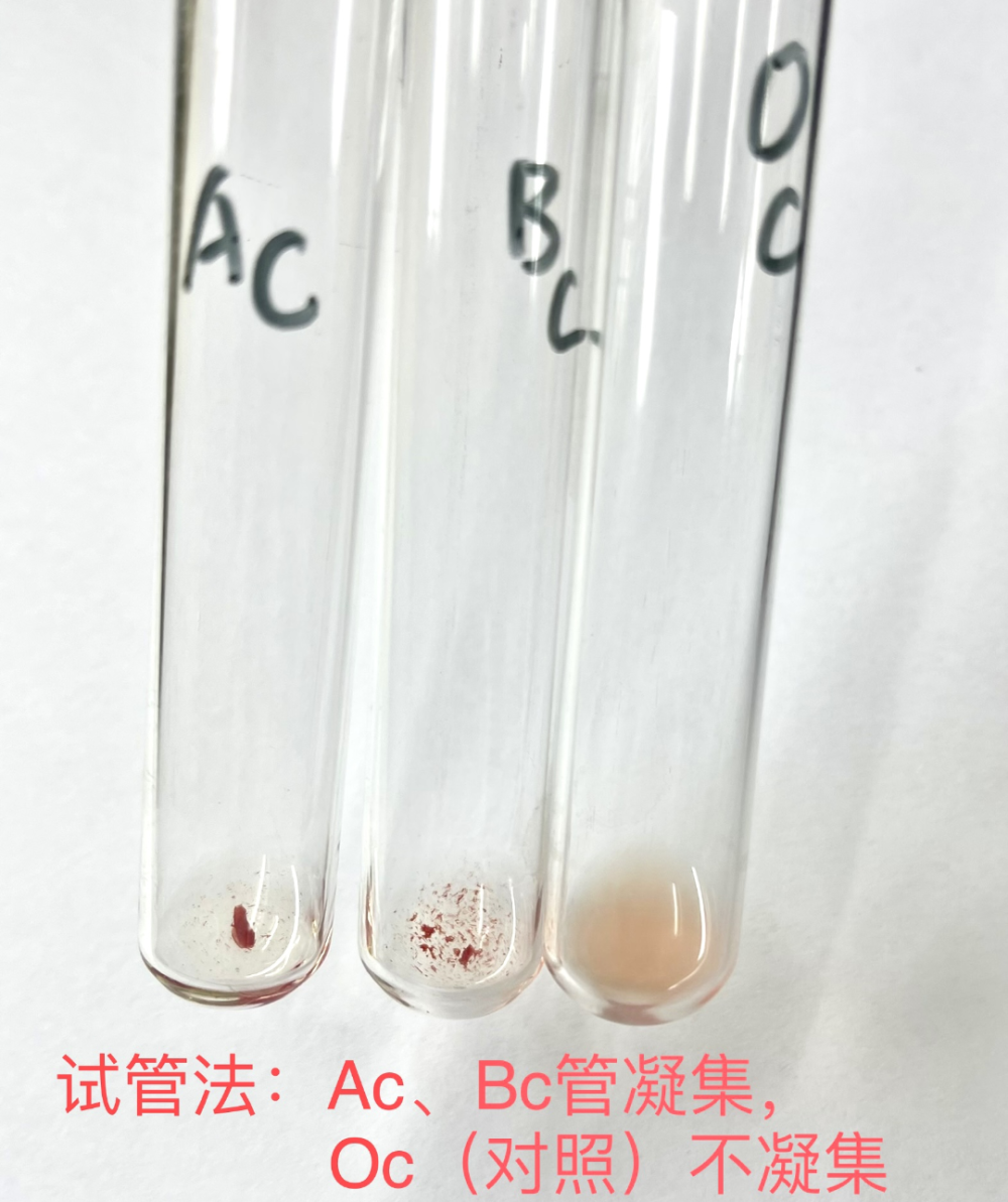 o型标准红细胞试剂表面没有a抗原和b抗原,对照孔,对照管均未出现凝集