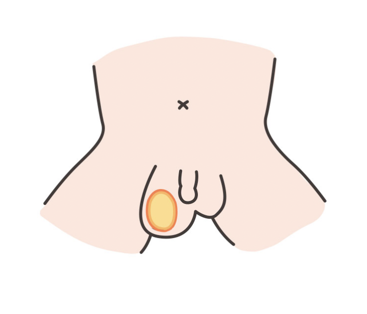男宝宝私处说明书:包皮,蛋蛋,小 jj,这些问题必须得知道