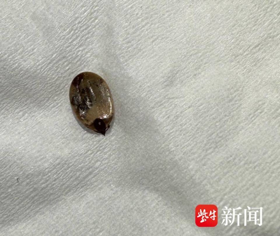 【视频】6岁童旅游归来发烧三天不退,原来又是蜱虫惹祸
