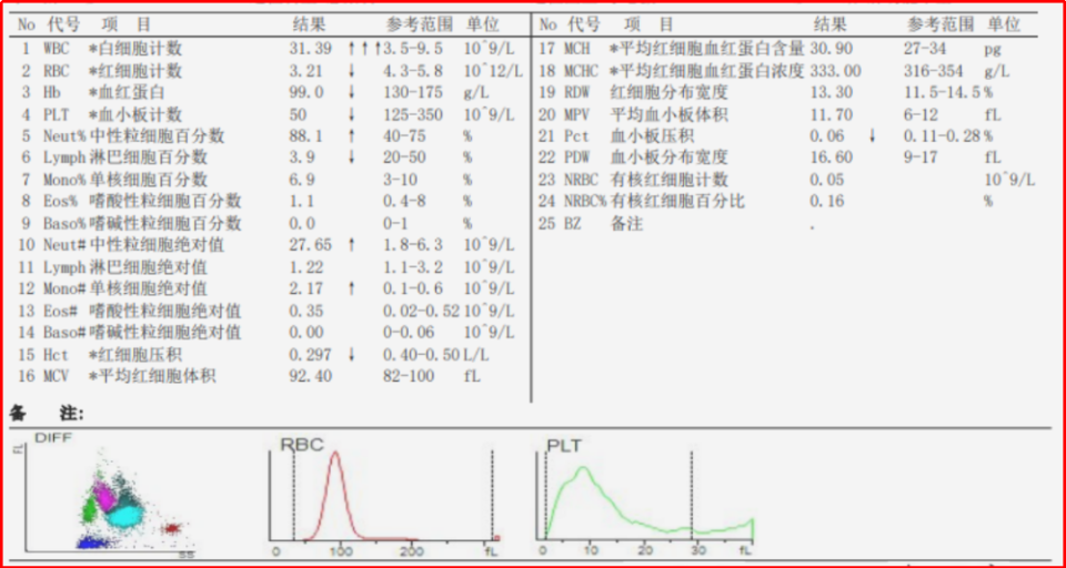 使用升白针后，外周血细胞形态「变形记」！_腾讯新闻