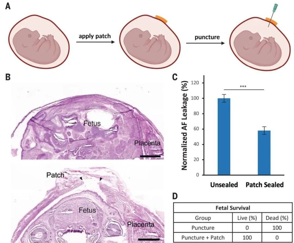 医用粘合剂叫什么名字医用高分子粘合剂登上《Science》_https://www.jmylbn.com_新闻资讯_第4张