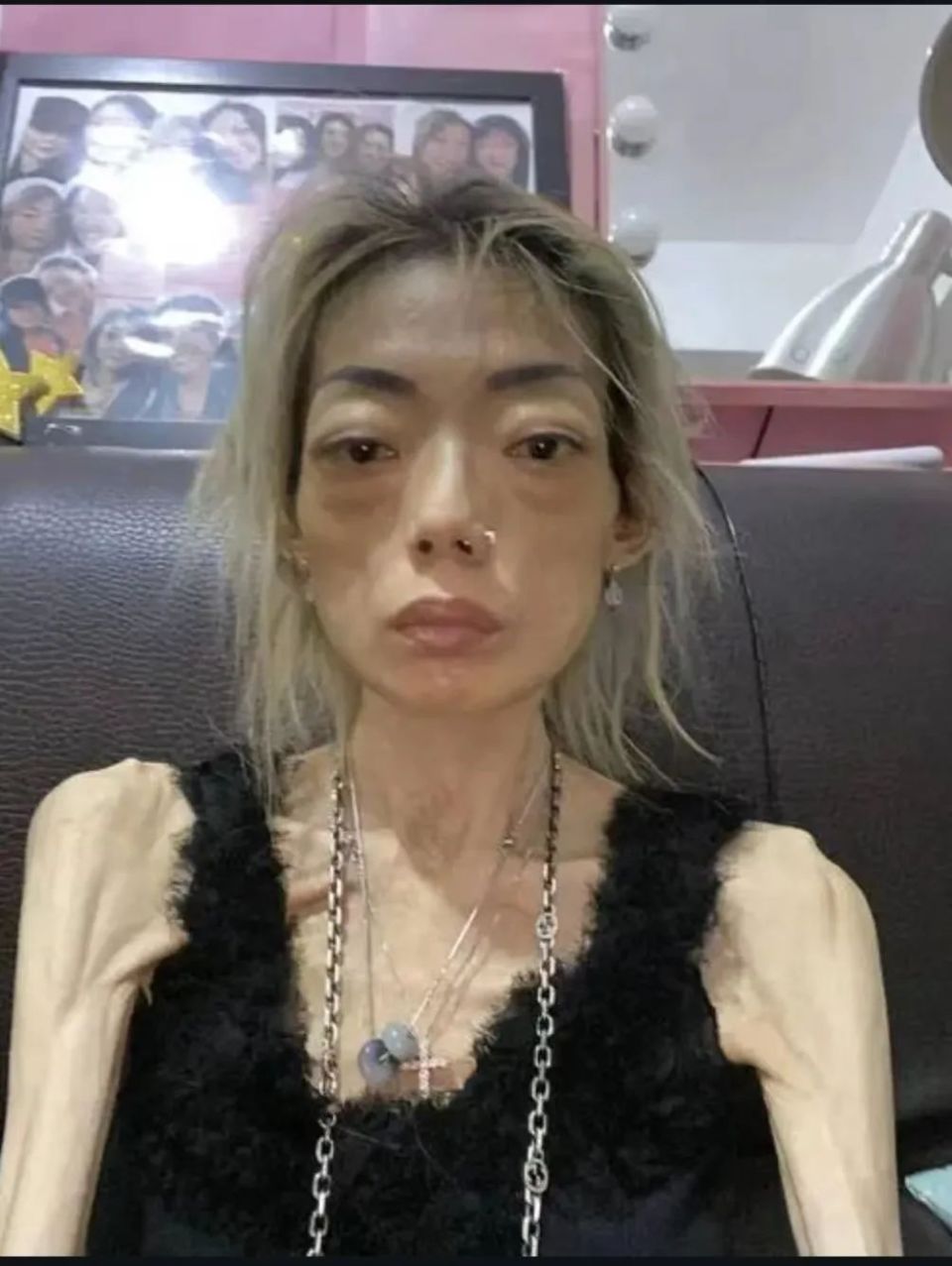 "内卷"下暴瘦的10位女星,有人瘦到22公斤,体力不支只能坐轮椅_腾讯