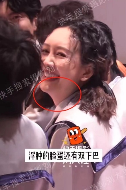 王鸥复工状态空降热搜,脸部发福双下巴明显,何炅下意识看其肚子