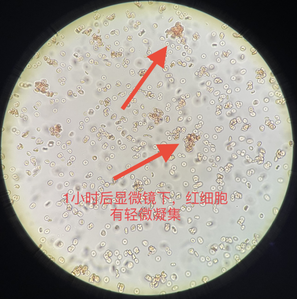 1,将制备好的2%～5%的红细胞悬液分别加1滴