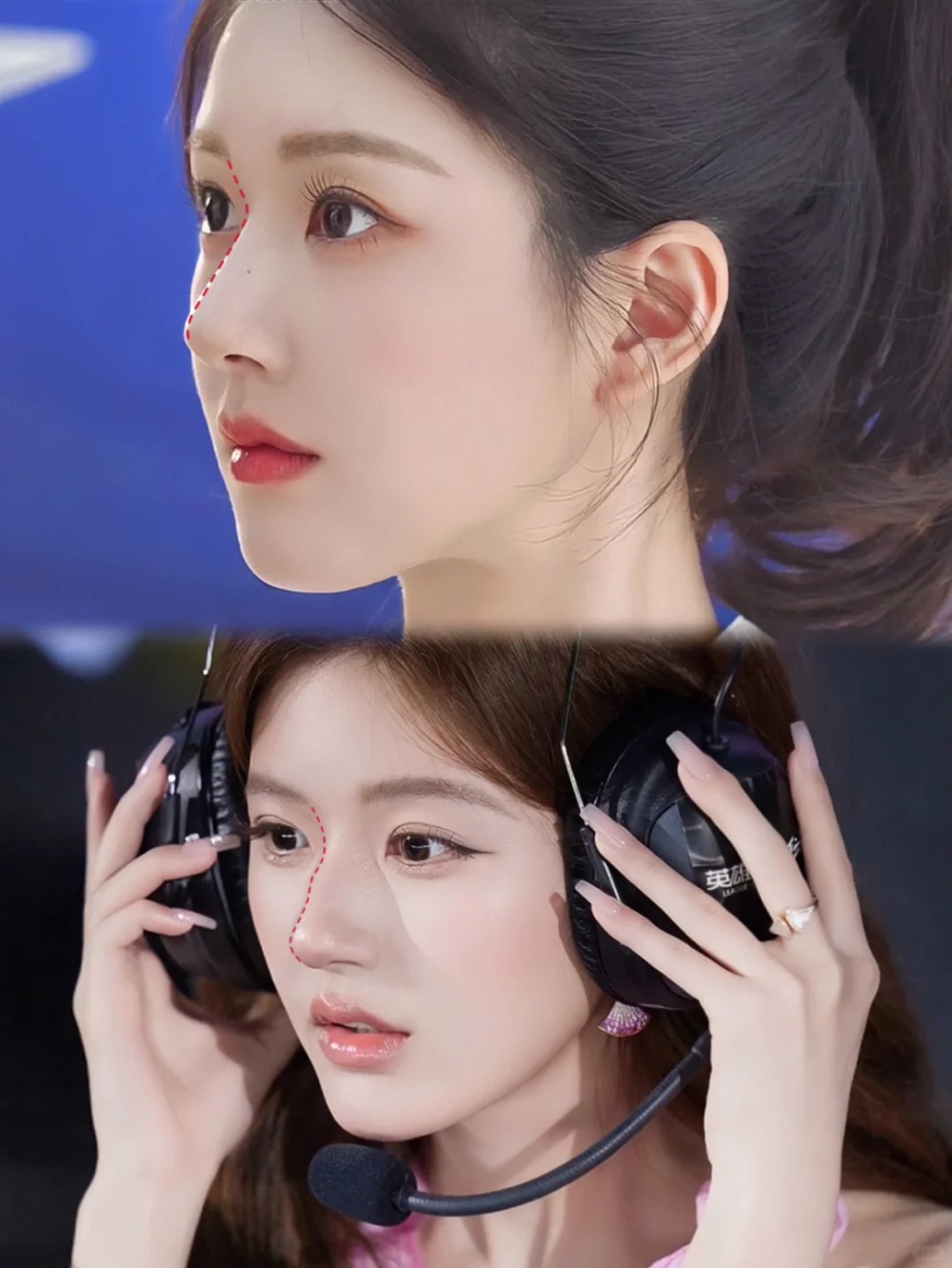 赵露思鼻子都这样了?穿搭时髦却满脸塑料感,高科技真把人给害了