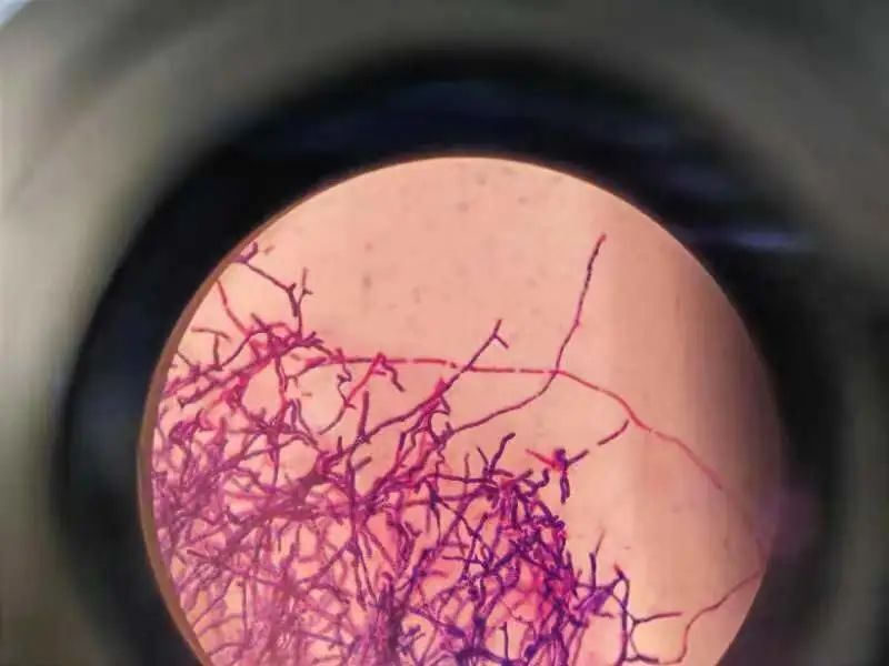 马尔尼菲青霉菌图片