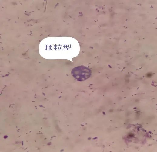 人芽囊原虫感染,你知多少?