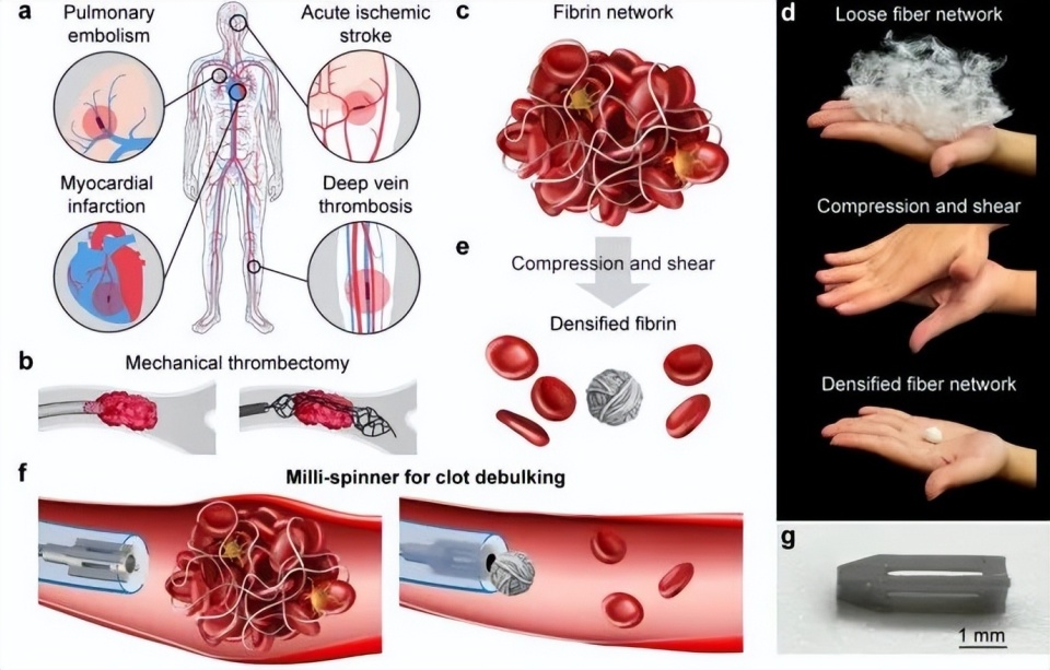 血凝哪些机器比较好专访赵芮可：用微型血栓机器人显著缩小血栓体积，或成脑梗心梗治疗新突破_https://www.jmylbn.com_新闻资讯_第6张