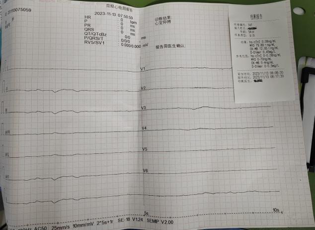 患者突发心跳停止超4小时,南宁市第一人民医院成功将其救回
